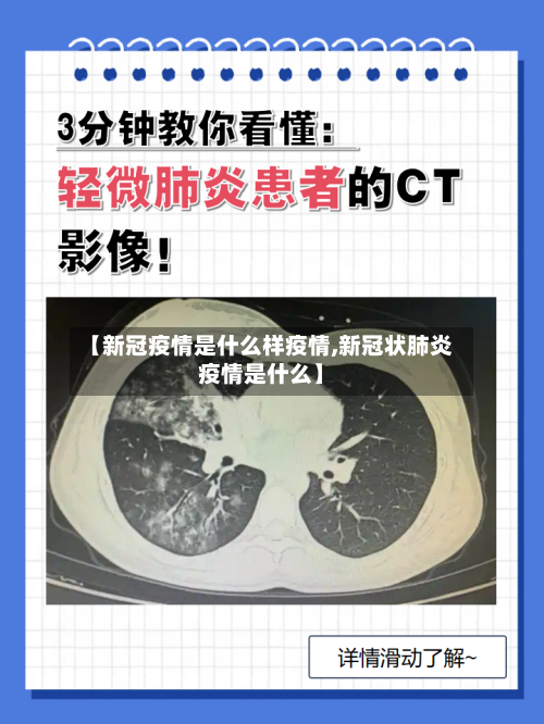 【新冠疫情是什么样疫情,新冠状肺炎疫情是什么】-第3张图片