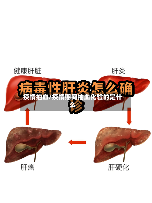 疫情抽血/疫情期间抽血化验的是什么-第1张图片