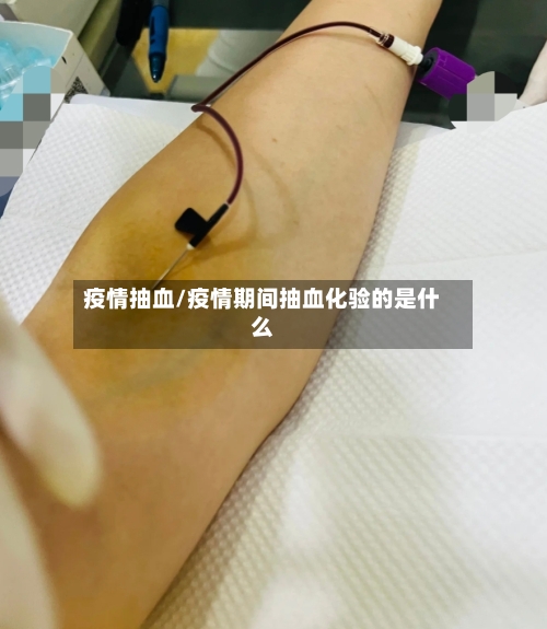 疫情抽血/疫情期间抽血化验的是什么-第3张图片