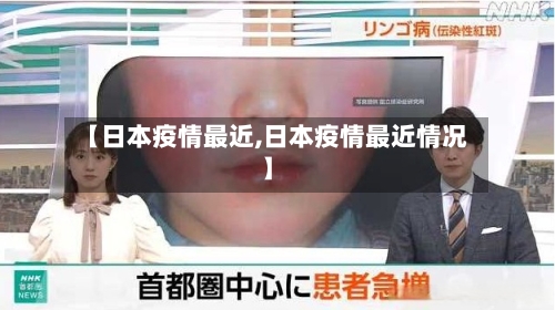 【日本疫情最近,日本疫情最近情况】-第2张图片